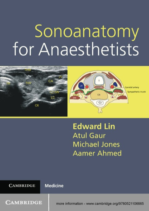 Sonoanatomy for Anaesthetists | Zookal Textbooks | Zookal Textbooks