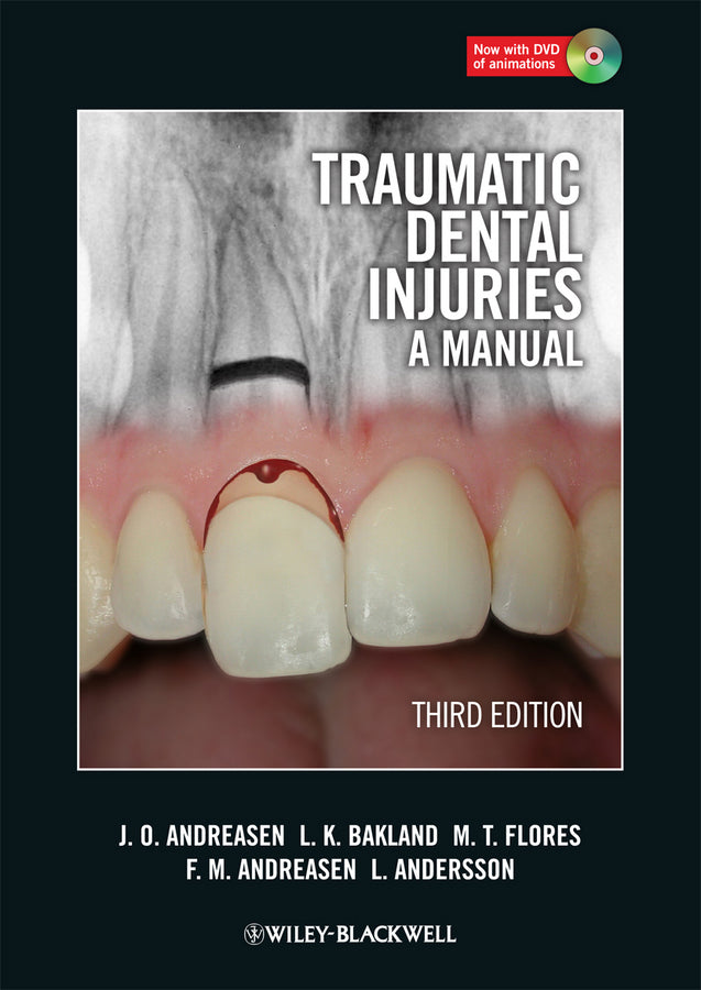 Traumatic Dental Injuries | Zookal Textbooks | Zookal Textbooks