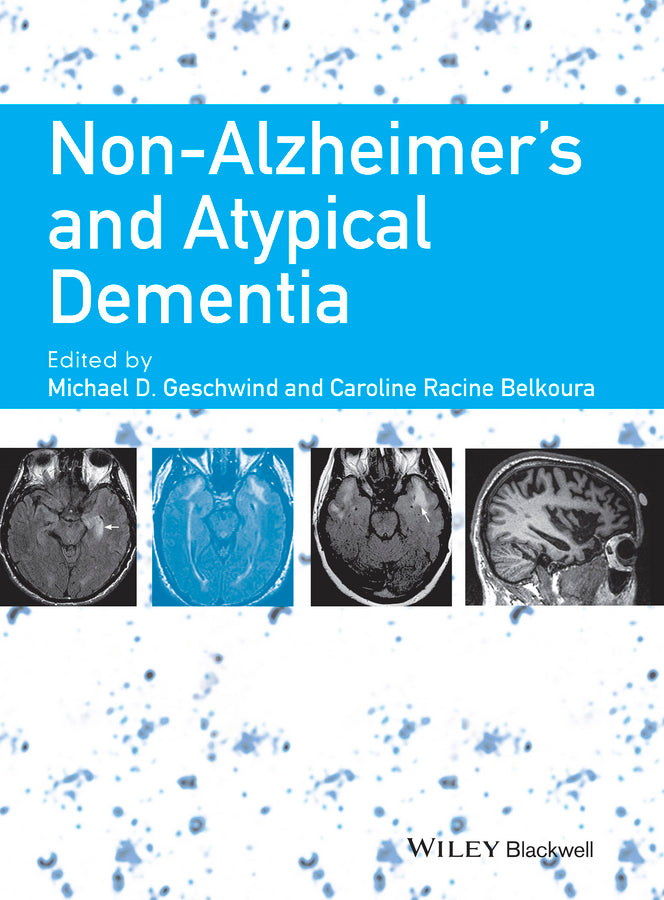 Non-Alzheimer's and Atypical Dementia | Zookal Textbooks | Zookal Textbooks