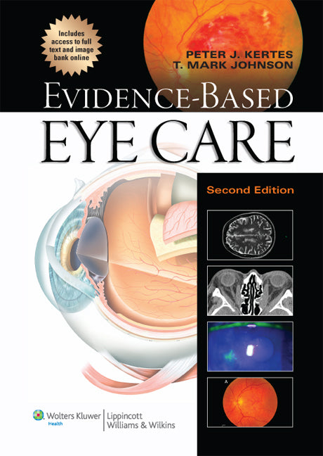 Evidence-Based Eye Care | Zookal Textbooks | Zookal Textbooks