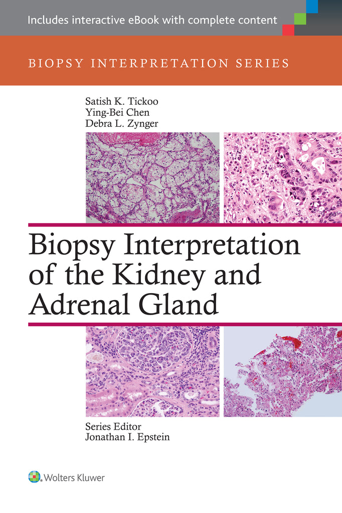 Biopsy Interpretation of the Kidney & Adrenal Gland | Zookal Textbooks | Zookal Textbooks