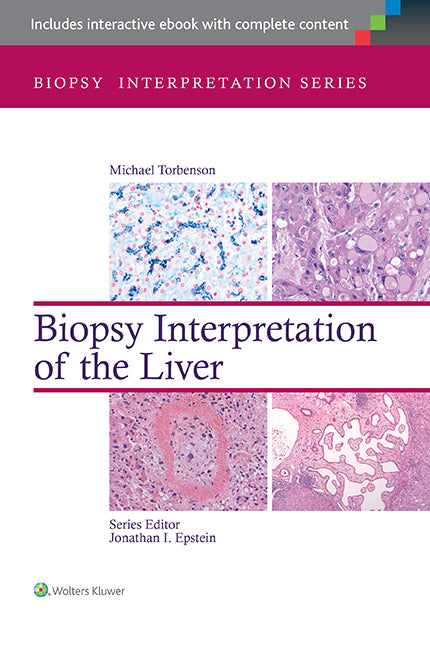 Biopsy Interpretation of the Liver | Zookal Textbooks | Zookal Textbooks