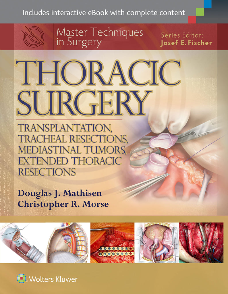 Master Techniques in Surgery: Thoracic Surgery:                 Transplantation, Tracheal Resections, Mediastinal Tumors,       Extended Thoracic Resections | Zookal Textbooks | Zookal Textbooks