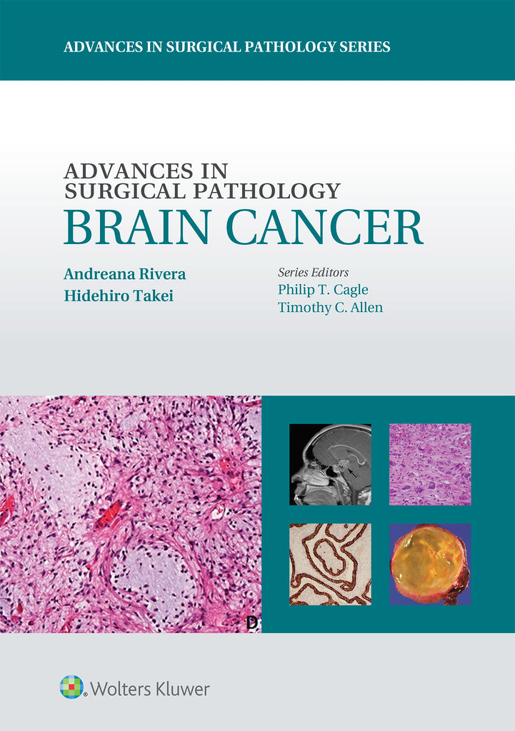 Advances in Surgical Pathology: Brain Cancer | Zookal Textbooks | Zookal Textbooks