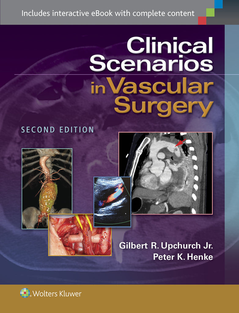 Clinical Scenarios in Vascular Surgery | Zookal Textbooks | Zookal Textbooks