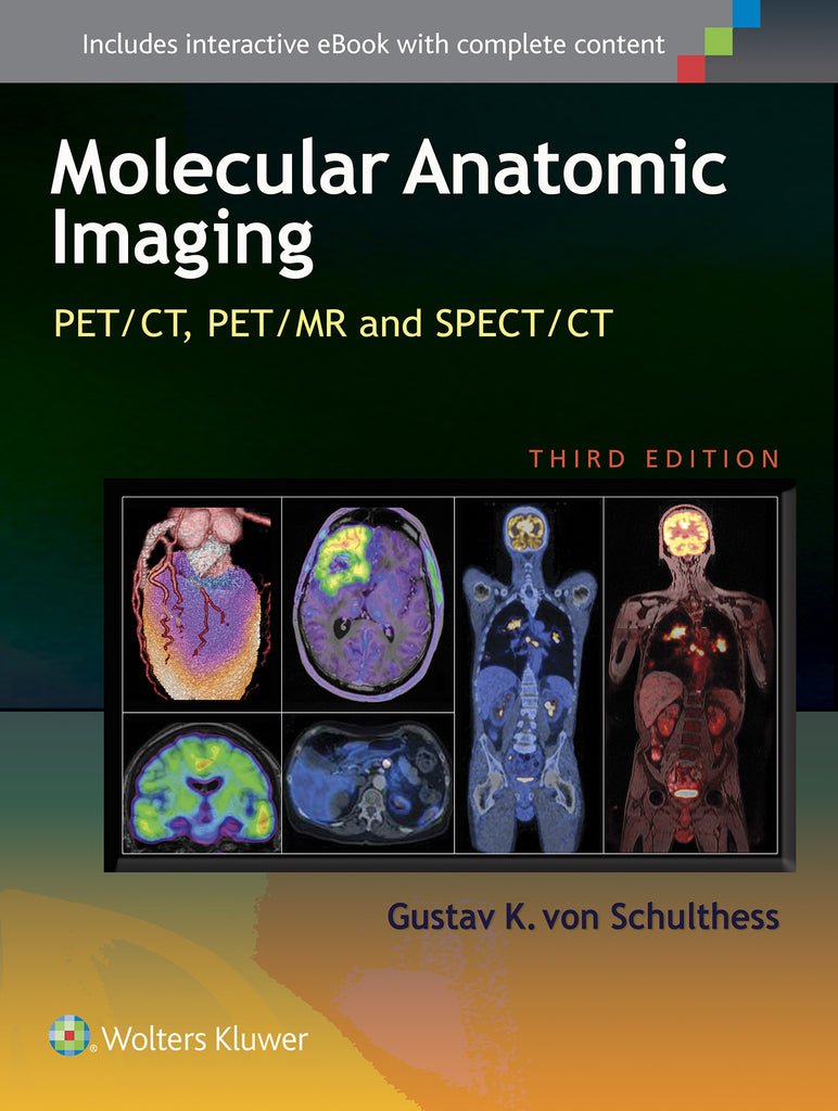 Molecular Anatomic Imaging | Zookal Textbooks | Zookal Textbooks