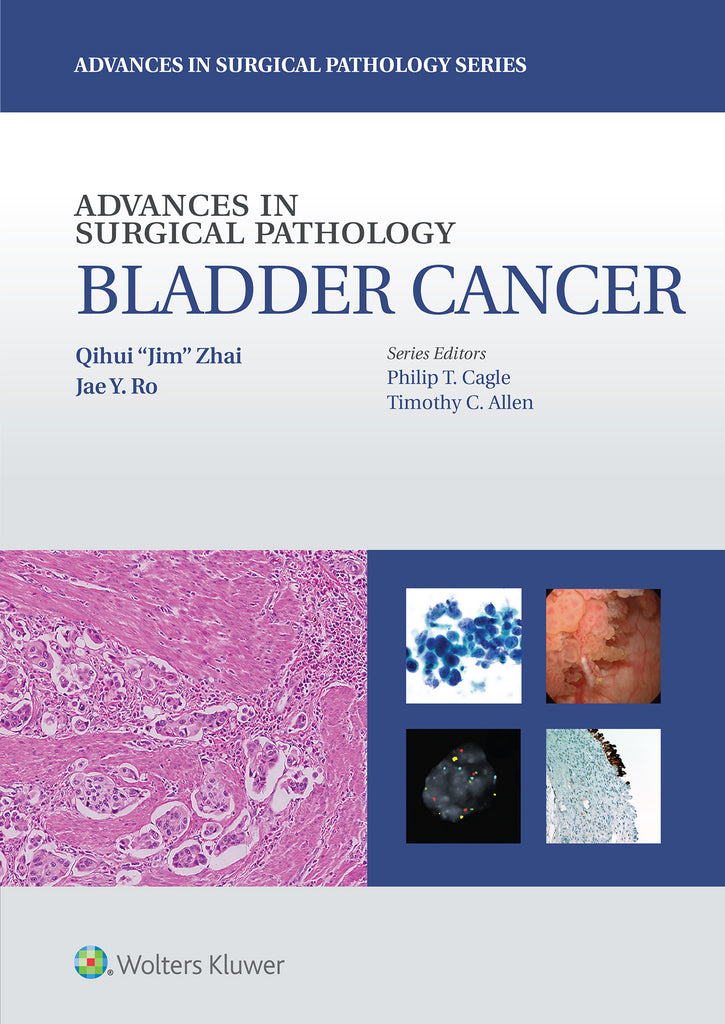 Advances in Surgical Pathology: Bladder Cancer | Zookal Textbooks | Zookal Textbooks