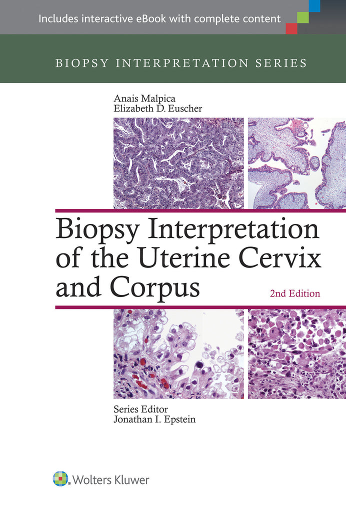 Biopsy Interpretation of the Uterine Cervix and Corpus | Zookal Textbooks | Zookal Textbooks