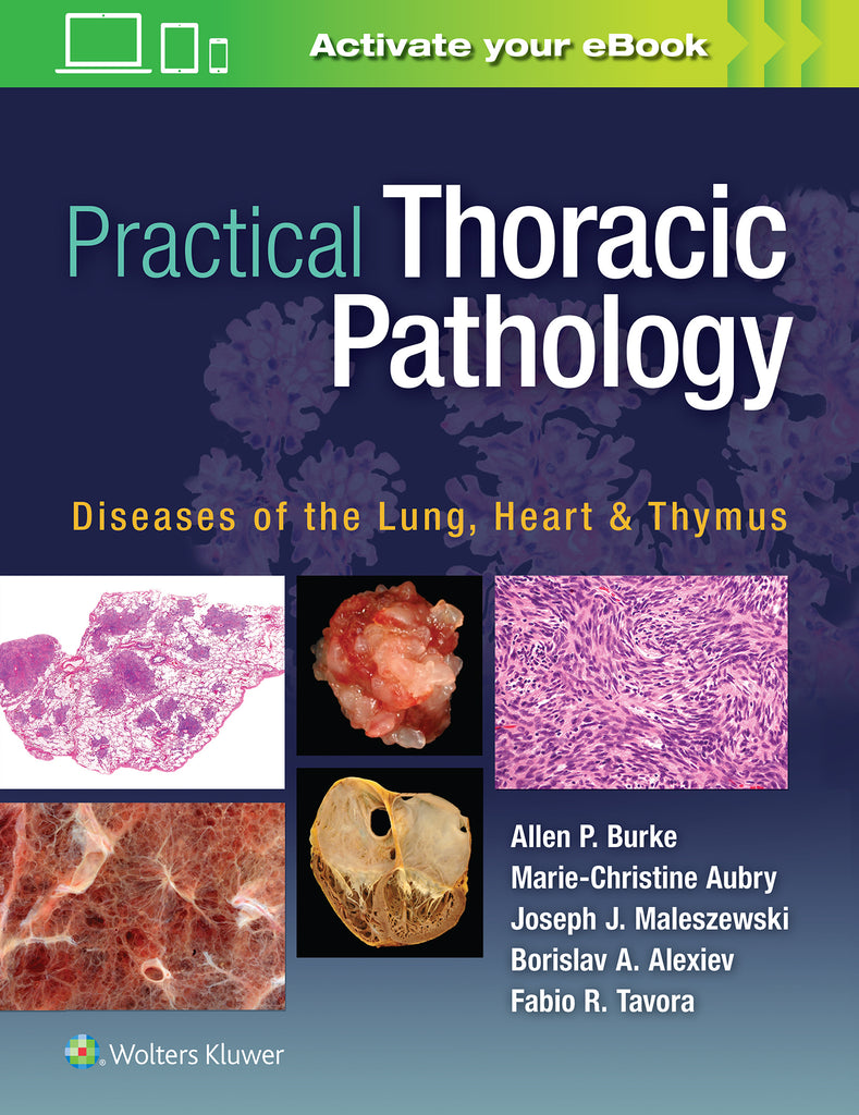 Practical Thoracic Pathology | Zookal Textbooks | Zookal Textbooks