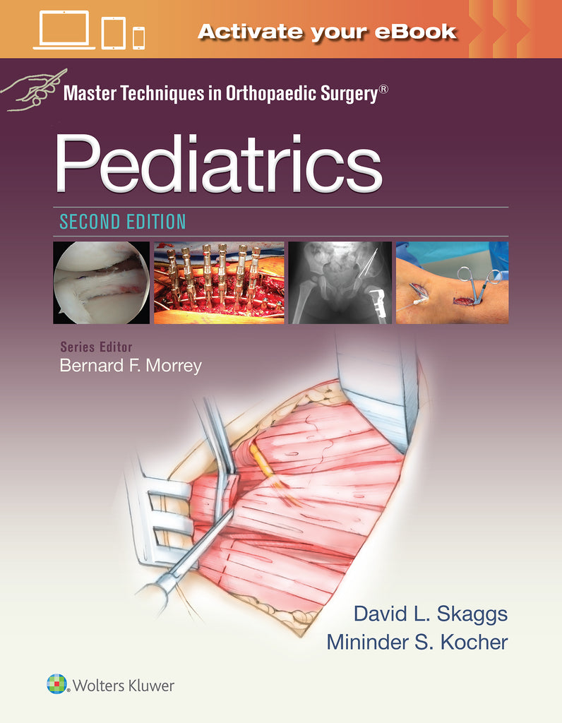 Master Techniques in Orthopaedic Surgery: Pediatrics | Zookal Textbooks | Zookal Textbooks