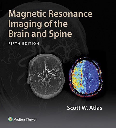 Magnetic Resonance Imaging of the Brain and Spine | Zookal Textbooks | Zookal Textbooks