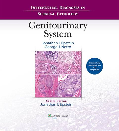 Differential Diagnoses in Surgical Pathology: Genitourinary System | Zookal Textbooks | Zookal Textbooks
