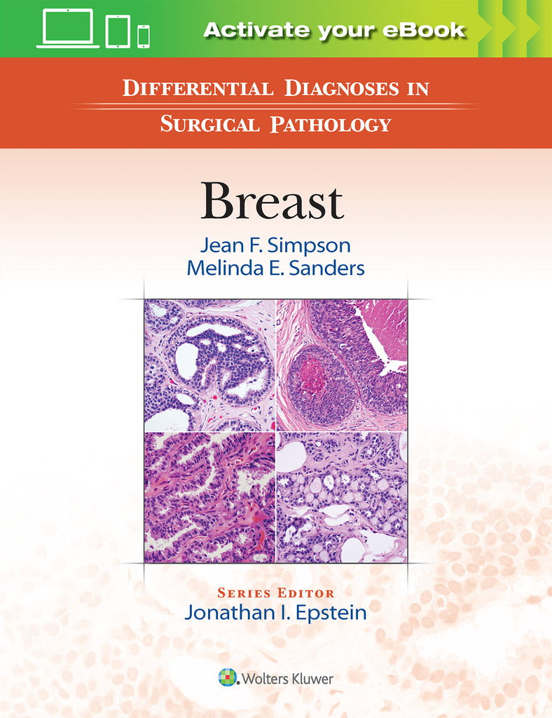 Differential Diagnoses in Surgical Pathology: Breast | Zookal Textbooks | Zookal Textbooks