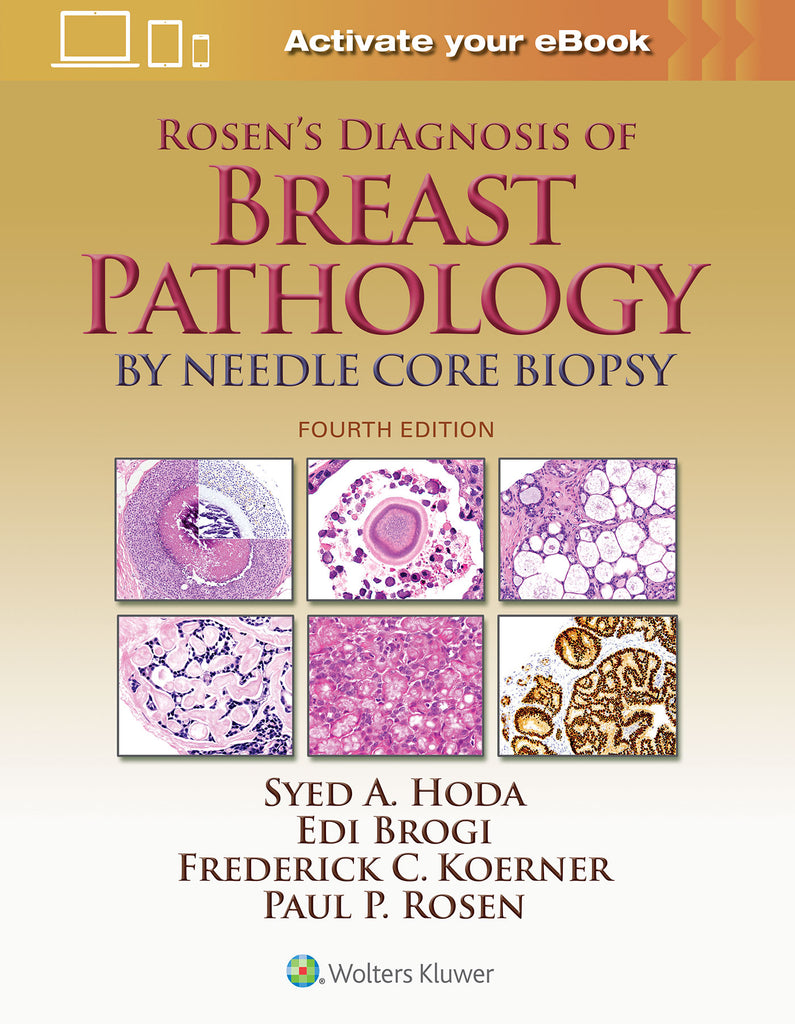 Rosen's Diagnosis of Breast Pathology by Needle Core Biopsy | Zookal Textbooks | Zookal Textbooks
