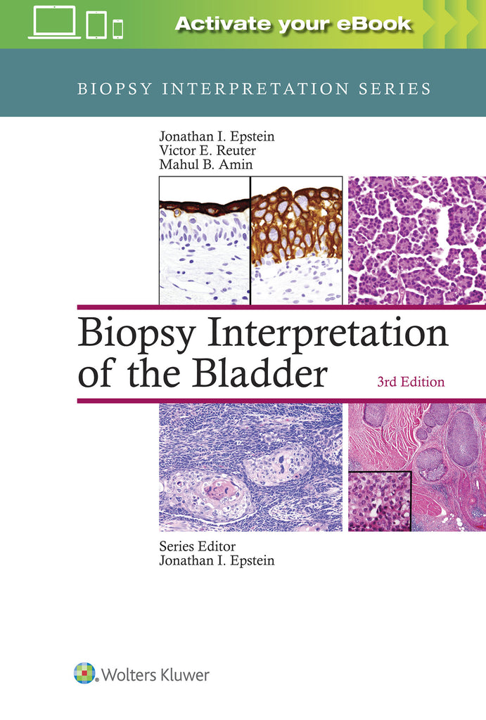 Biopsy Interpretation of the Bladder | Zookal Textbooks | Zookal Textbooks