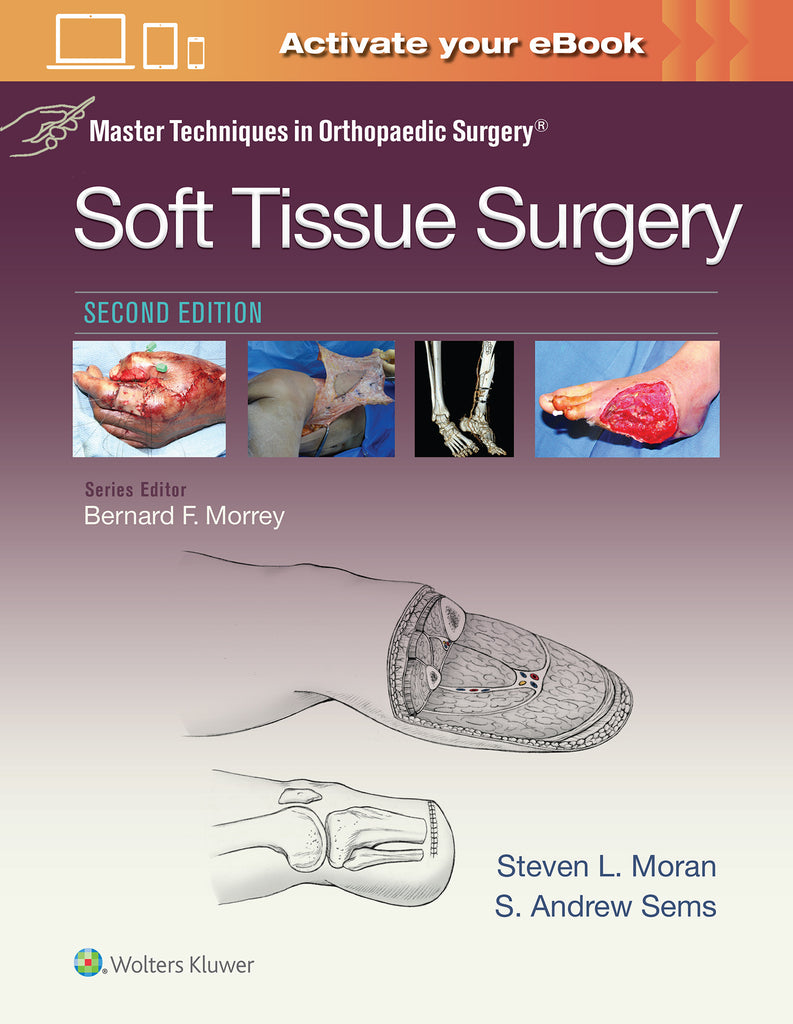 Master Techniques in Orthopaedic Surgery: Soft Tissue Surgery | Zookal Textbooks | Zookal Textbooks