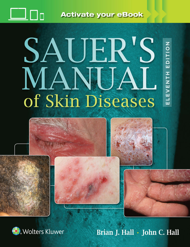 Sauer's Manual of Skin Diseases | Zookal Textbooks | Zookal Textbooks