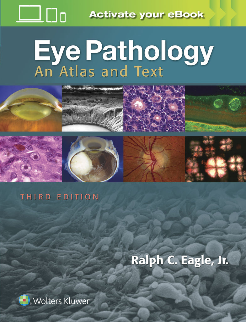 Eye Pathology | Zookal Textbooks | Zookal Textbooks