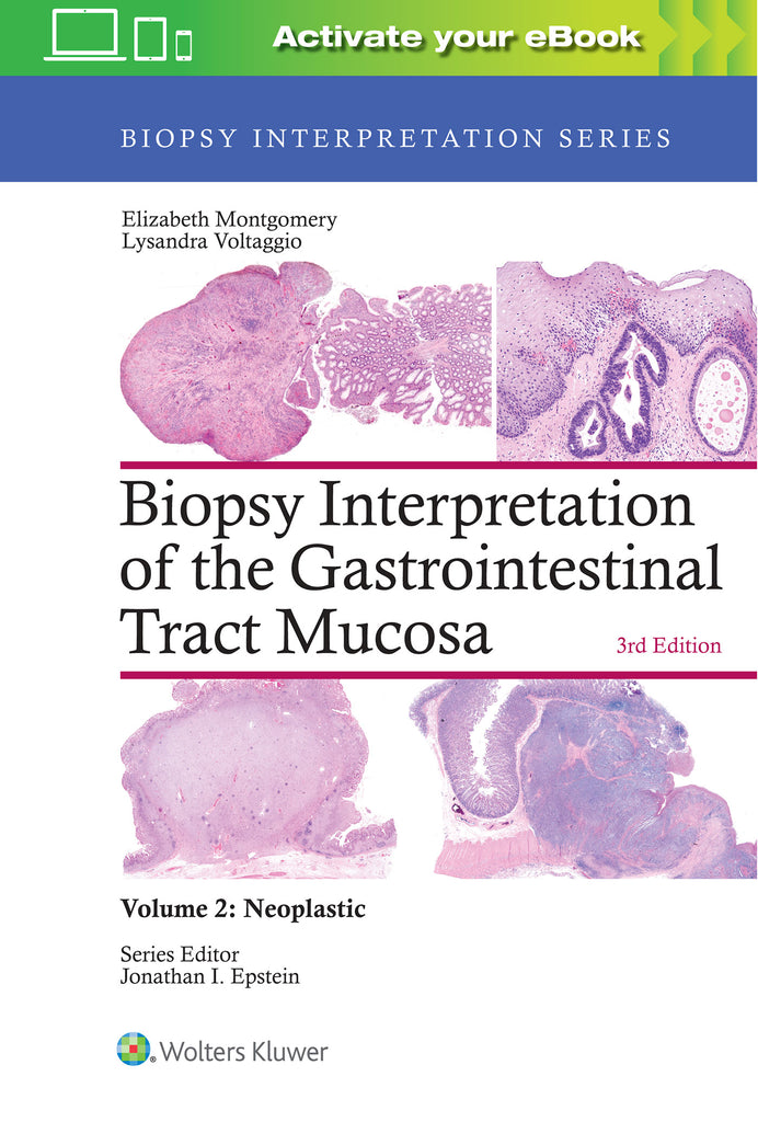 Biopsy Interpretation of the Gastrointestinal Tract Mucosa:     Volume 2: Neoplastic | Zookal Textbooks | Zookal Textbooks