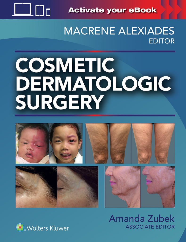 Cosmetic Dermatologic Surgery | Zookal Textbooks | Zookal Textbooks