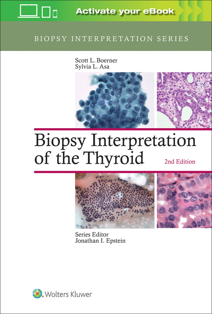 Biopsy Interpretation of the Thyroid | Zookal Textbooks | Zookal Textbooks