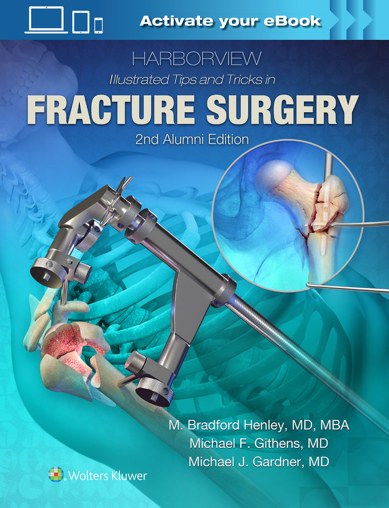 Harborview Illustrated Tips and Tricks in Fracture Surgery | Zookal Textbooks | Zookal Textbooks