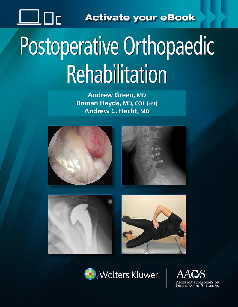 Postoperative Orthopaedic Rehabilitation | Zookal Textbooks | Zookal Textbooks