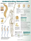 Understanding Osteoporosis | Zookal Textbooks | Zookal Textbooks