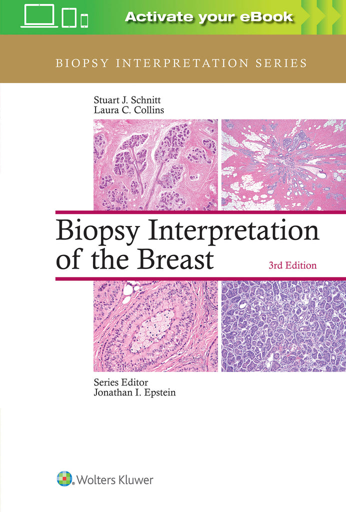 Biopsy Interpretation of the Breast | Zookal Textbooks | Zookal Textbooks