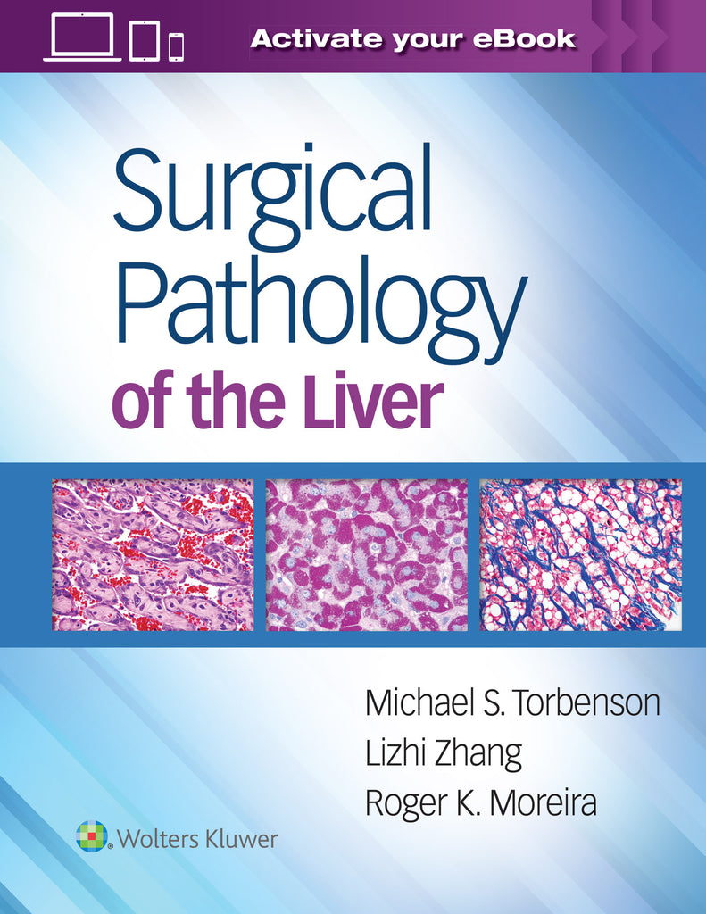 Surgical Pathology of the Liver | Zookal Textbooks | Zookal Textbooks