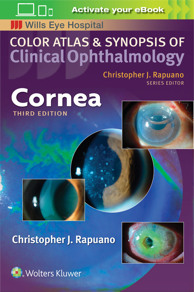 Color Atlas and Synopsis of Clinical Ophthalmology - Cornea | Zookal Textbooks | Zookal Textbooks
