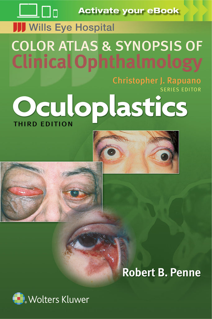 Color Atlas and Synopsis of Clinical Ophthalmology | Zookal Textbooks | Zookal Textbooks