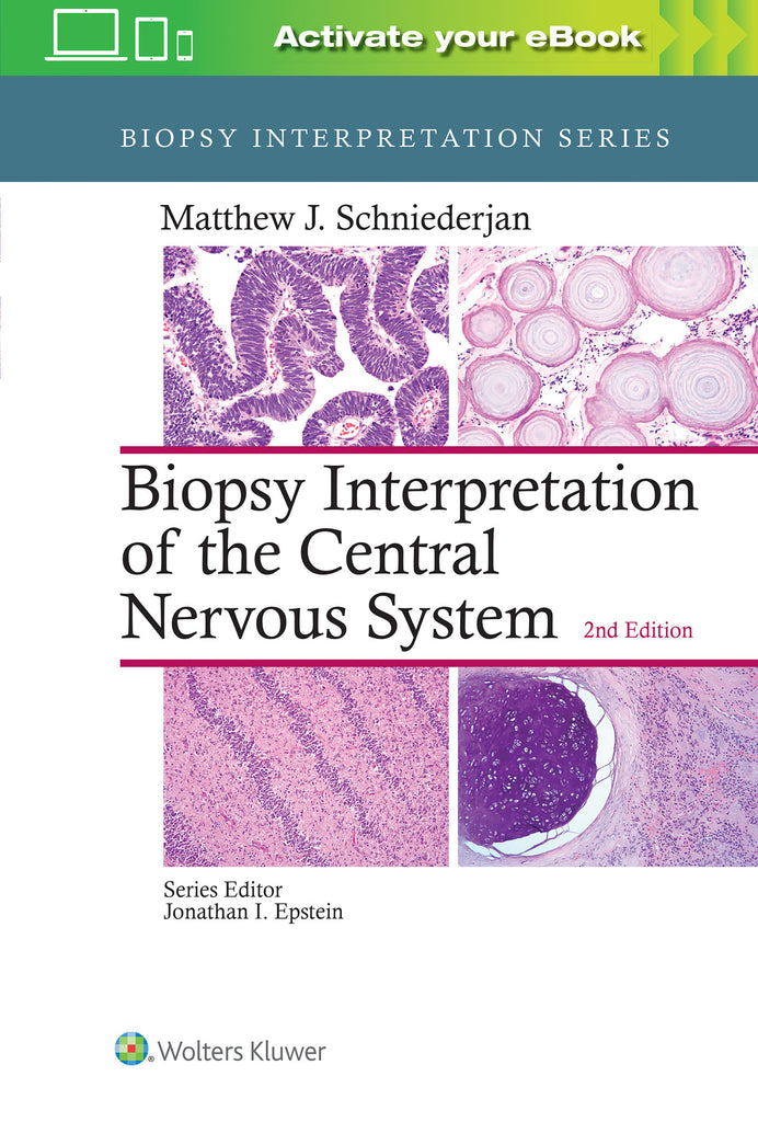Biopsy Interpretation of the Central Nervous System | Zookal Textbooks | Zookal Textbooks