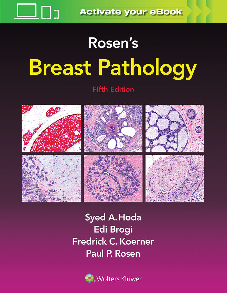 Rosen's Breast Pathology | Zookal Textbooks | Zookal Textbooks