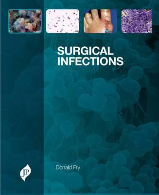 Surgical Infections | Zookal Textbooks | Zookal Textbooks
