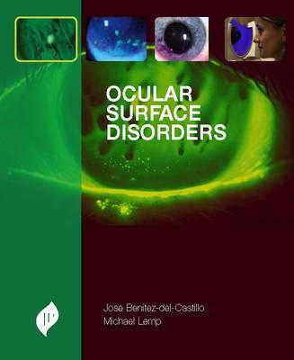 Ocular Surface Disorders | Zookal Textbooks | Zookal Textbooks