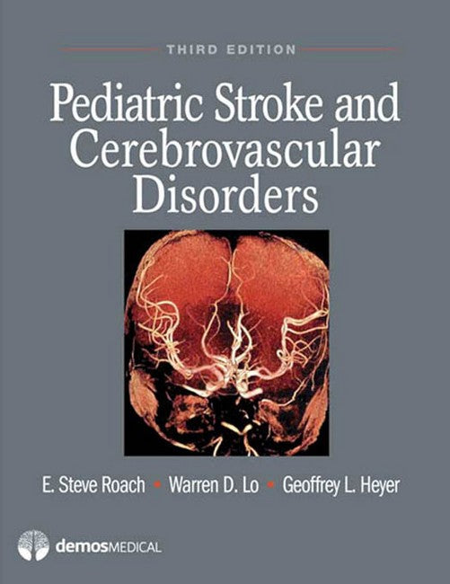 Pediatric Stroke and Cerebrovascular Disorders | Zookal Textbooks | Zookal Textbooks