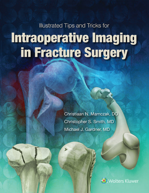 Illustrated Tips and Tricks for Intraoperative Imaging in Fracture Surgery | Zookal Textbooks | Zookal Textbooks