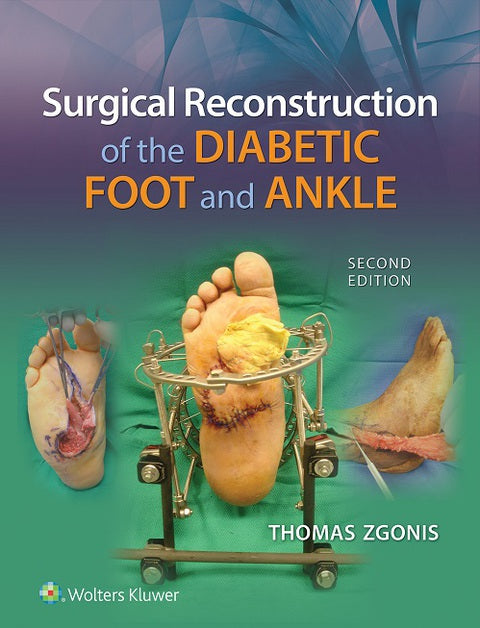 Surgical Reconstruction of the Diabetic Foot and Ankle | Zookal Textbooks | Zookal Textbooks