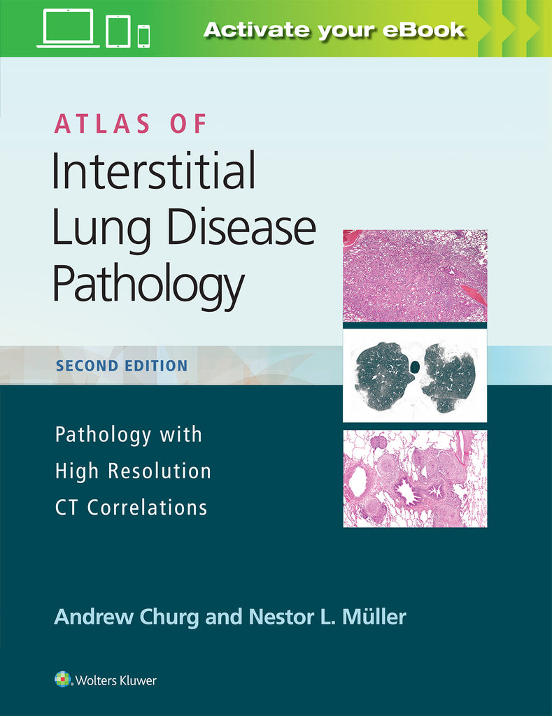Atlas of Interstitial Lung Disease Pathology | Zookal Textbooks | Zookal Textbooks