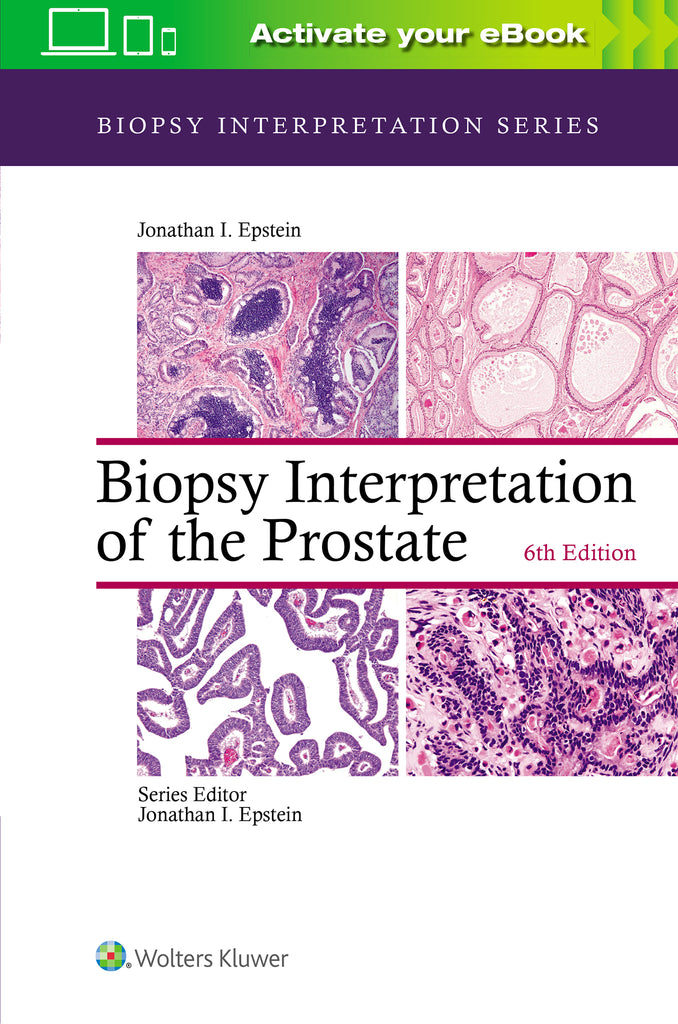 Biopsy Interpretation of the Prostate | Zookal Textbooks | Zookal Textbooks