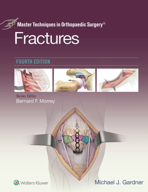 Master Techniques in Orthopaedic Surgery: Fractures | Zookal Textbooks | Zookal Textbooks