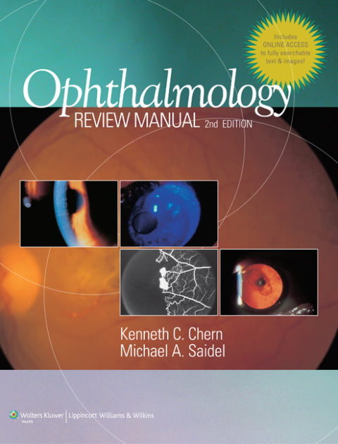 Ophthalmology Review Manual | Zookal Textbooks | Zookal Textbooks