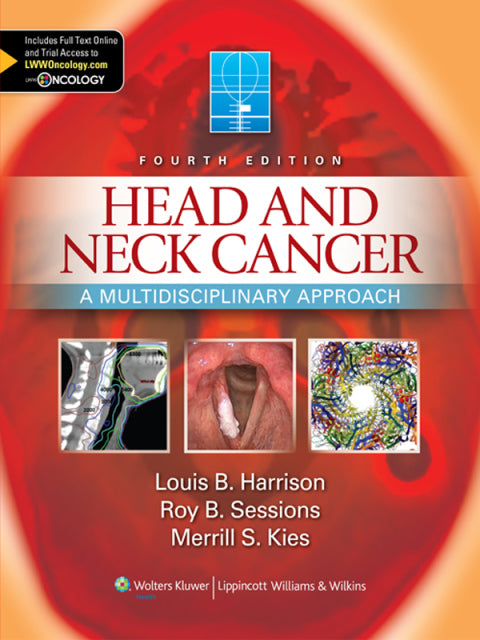 Head and Neck Cancer | Zookal Textbooks | Zookal Textbooks