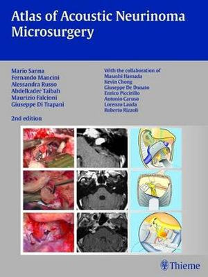Atlas of Acoustic Neurinoma Microsurgery | Zookal Textbooks | Zookal Textbooks